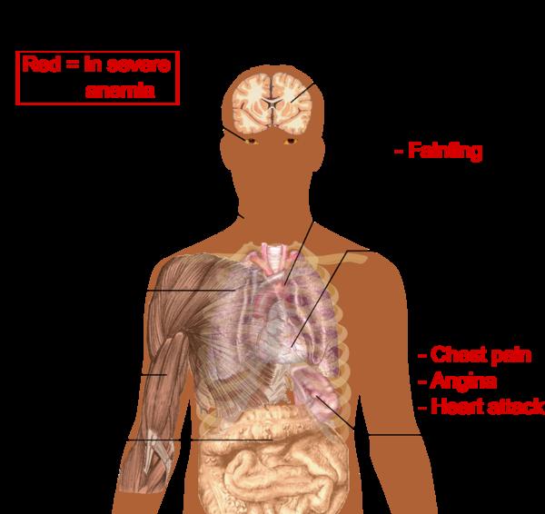 Symptoms of alcohol dependency