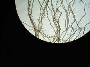Symptoms of nerve damage