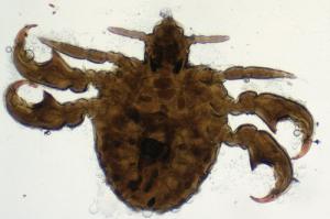 Symptoms of pubic lice