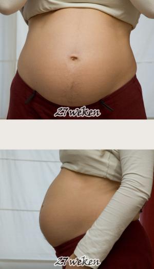 Tailbone pain during pregnancy