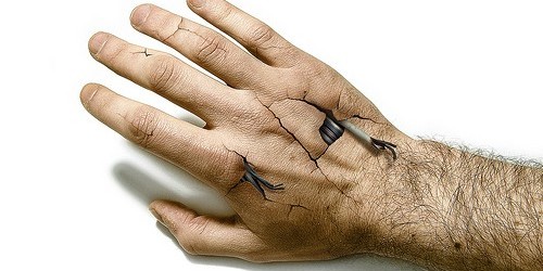 Tackling Your Tendinitis During Your Workout