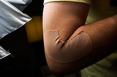 Tennis elbow exercises