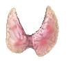 The cause of Thyroid eye disease