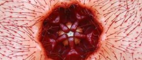 The hoodia patch: Better than capsules?