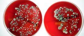 Therapy for mrsa