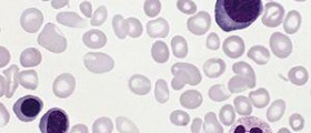 Therapy for polycythemia vera