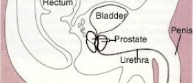 Therapy for prostate cancer