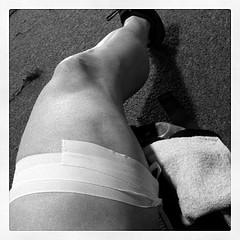 Therapy for pulled hamstring