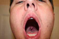 Throat inflammation facts