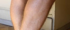 Throbbing leg pain