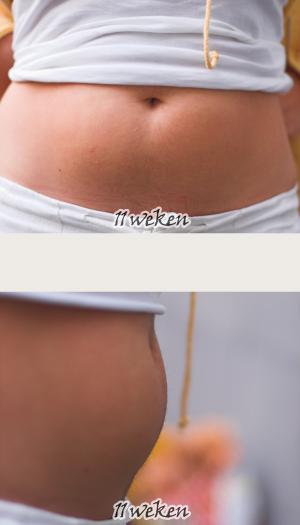 Tips to prevent heartburn in pregnancy