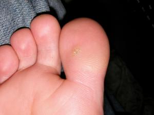 foot arch cramps at night