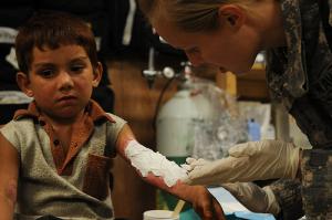 Treatment for a second degree burn