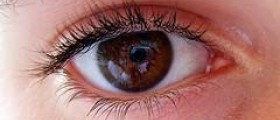 Treatment for crows feet