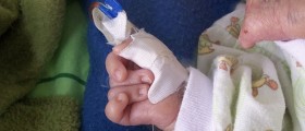 Trisomy 18