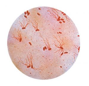 Typhoid fever symptoms