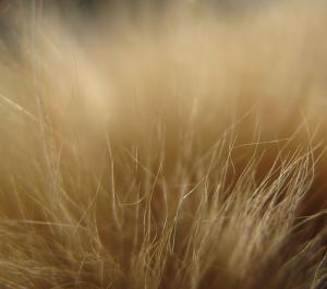 Unwanted body hair problems and solution methods