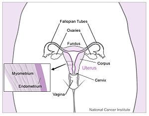 Uterine ablation facts