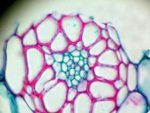 Vascular resistance facts