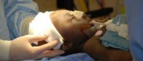 Viral encephalitis in children