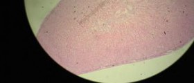 Vitamin C and your adrenal glands