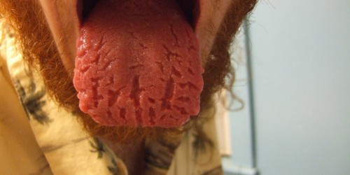 9 Secrets Your Tongue Reveal About Your Health: Are You Brave Enough To Look?