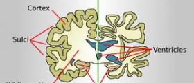 What are epilepsy causes