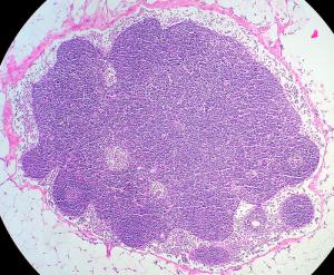 What are lymph nodes