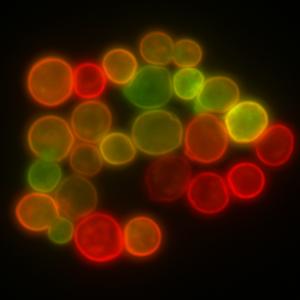 What causes a yeast infection?