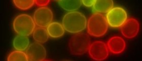 What causes a yeast infection?
