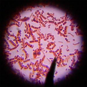 What is a bacterial infection