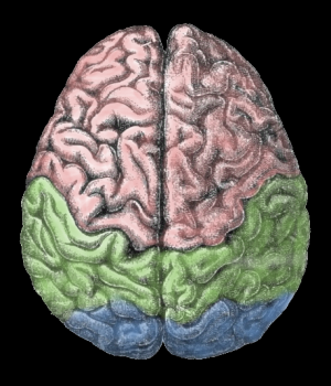 What is cerebral hemorrhage