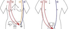 What is precocious puberty
