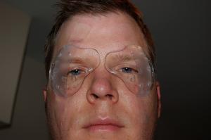 What to avoid during LASIK recovery