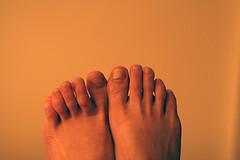 White spots on toenails