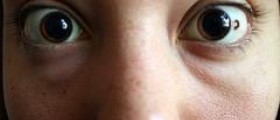 Who wants a good LASIK doctor?