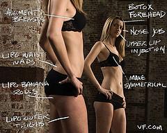 Why are breast success pills favored over breast augmentation surgery?