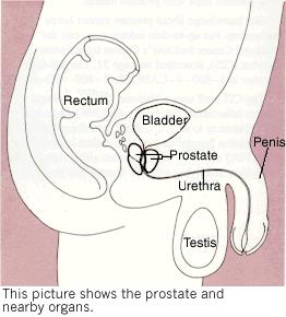 Why is prostate-specific antigen test done