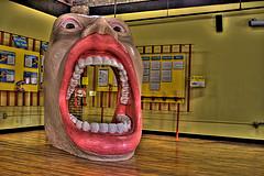 Xerostomia: Reason of dry mouth